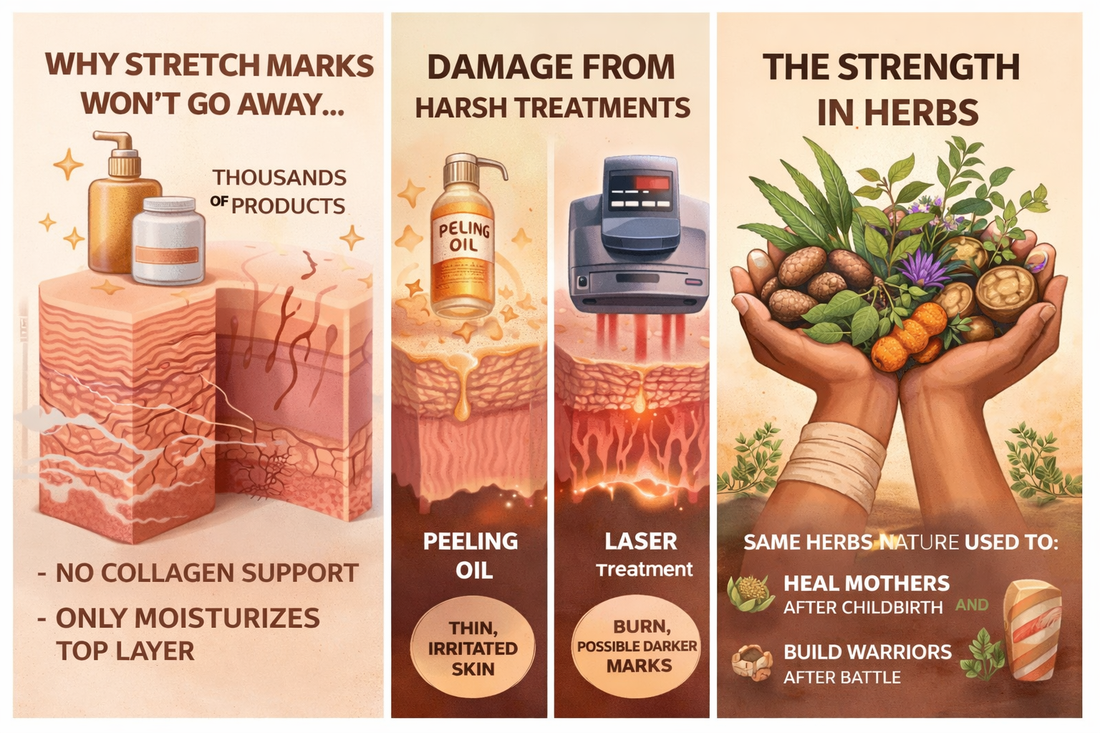 Vision behind YECHI BODY SECRET popular  STRETCH MARK solution